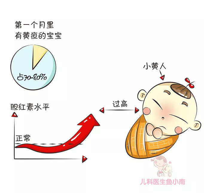 婴儿黄疸消退只用四招