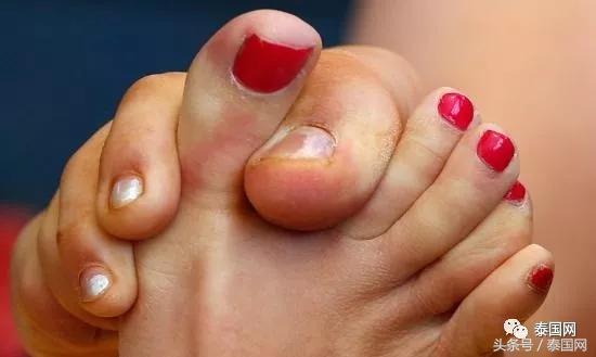 火遍全泰的這種“小魚(yú)啃腳Spa”，你可知有多大健康風(fēng)險(xiǎn)？