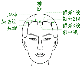 「中医适宜技术」第一篇 针刺技术｜第2章头针技术