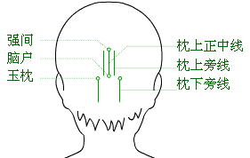 「中医适宜技术」第一篇 针刺技术｜第2章头针技术