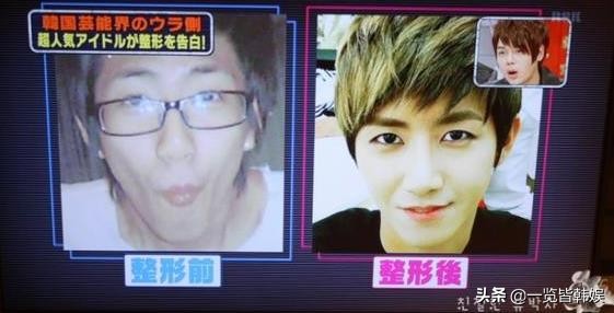 黄光熙公开整容苦衷 狂怼李孝利艺能感爆棚 自嘲