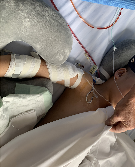 让人心痛!继父连砍4刀，女孩面临高位截瘫：孩子