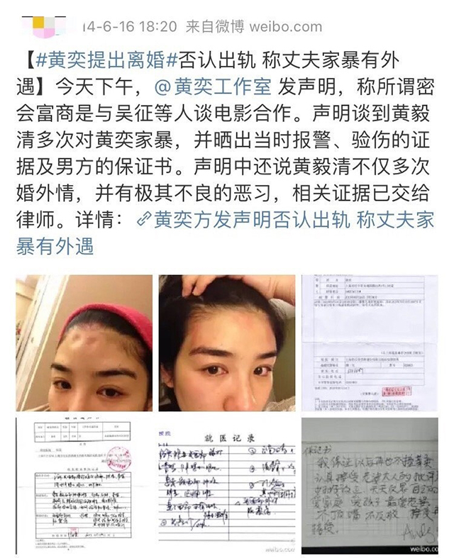 Does yellow Yi former husband have much residue? Pregnancy home Bao Pin is numerous, a few 0 are installed to photograph surveillance resembling a head in the home she