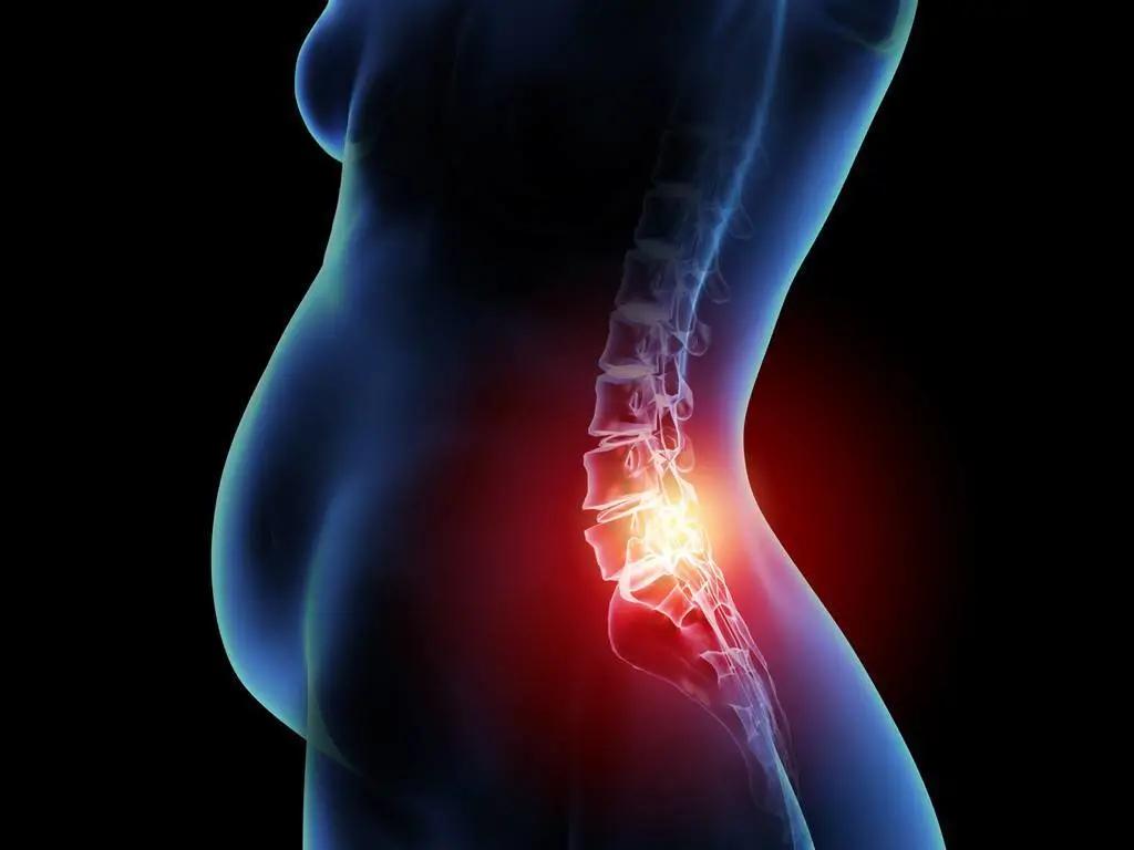 應采兒二胎后腰疼到哭，10個產婦8個腰疼