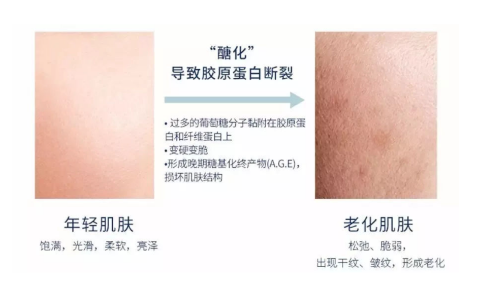 不同年龄段怎么选抗老护肤品？搞懂“重点”，才能事半功倍
