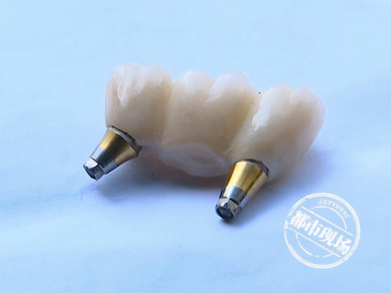 南昌：老人花费5万在“摩尔齿科”种牙，他说自己遭了罪