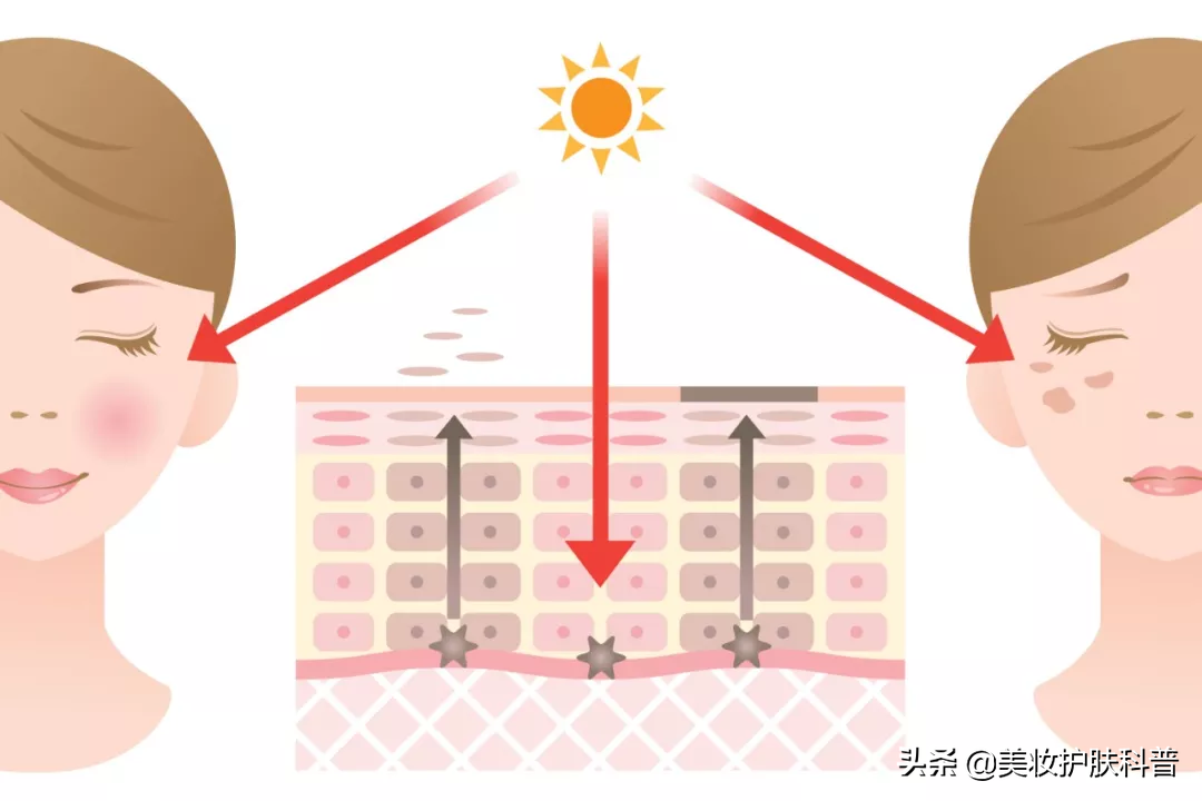 三月不防晒，五月斑上来，如何预防和治疗日晒斑-第2张图片-农百科