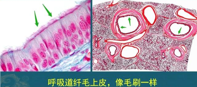 从肺里咳出的痰是什么物质？是体内毒素吗？秋季养肺该怎么做？