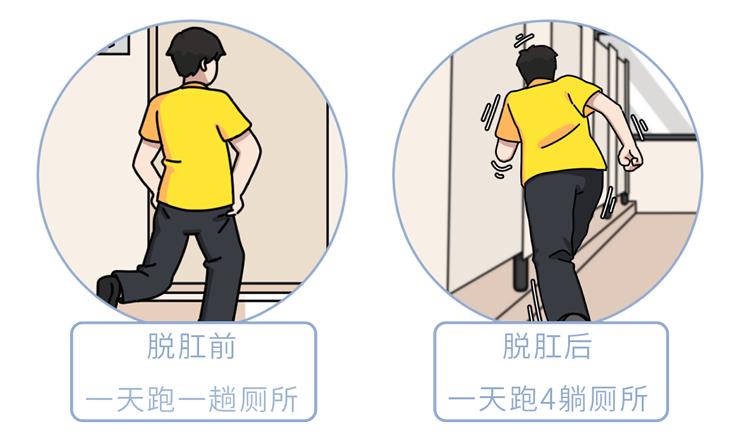 脫肛是一種怎樣的體驗？4個因素是脫肛「根源」，不要忽視了 - 資訊咖