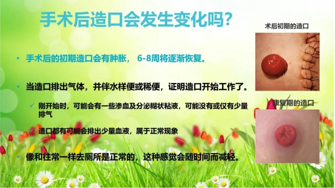 健康科普大赛获奖作品展示⑦丨肠造口术后患者健康教育