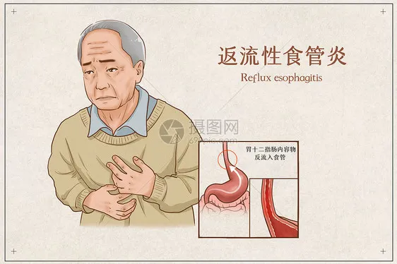 反流性食管炎的禁忌你知道么？