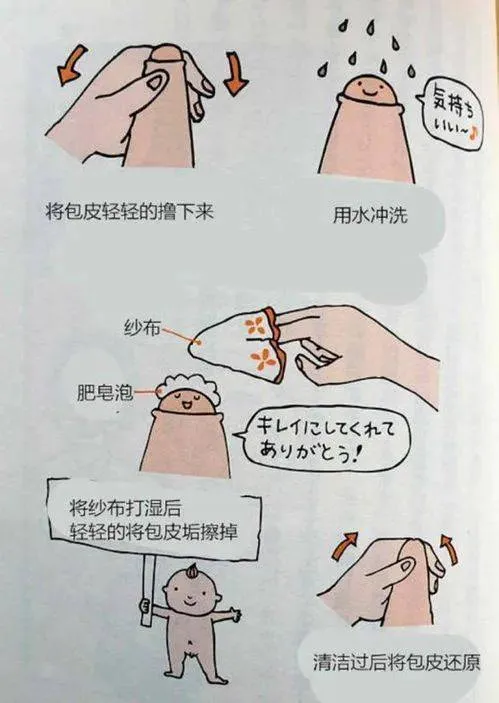 包皮垢該怎麼清理? 如果不清理會怎麼樣?