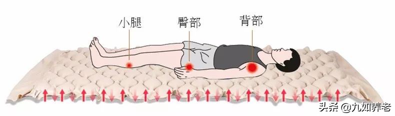 夏季卧床老人如何预防褥疮？日常护理要做好这 5 点-第1张图片-农百科