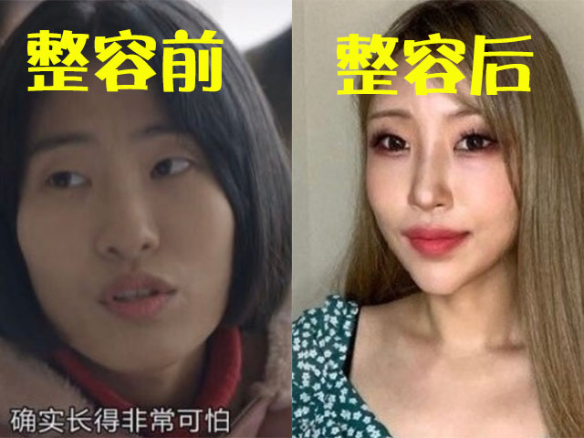 请回答1988王子贤扮演者整容称自己曾因为长相被人骂哭