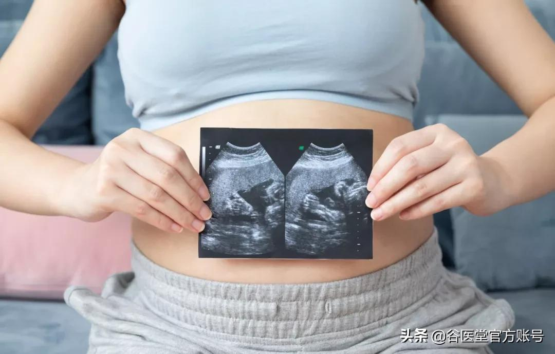 “多囊卵巢综合征”难怀孕怎么调理?女性卵巢保养早知道
