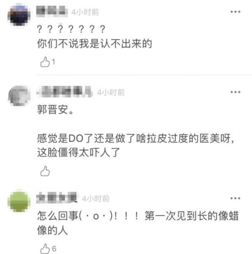 56岁视帝郭晋安现身脸太僵，被疑医美过度，网友力挺：自然老去