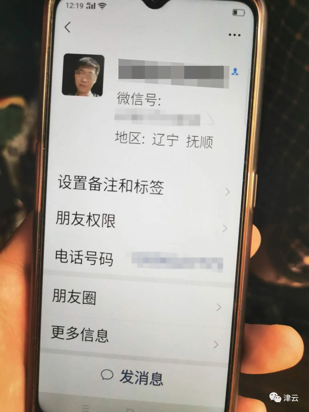开水浇头、烟头烫疤、钳子拔牙……遭亲妈男友虐待,6岁女童伤情鉴定出炉