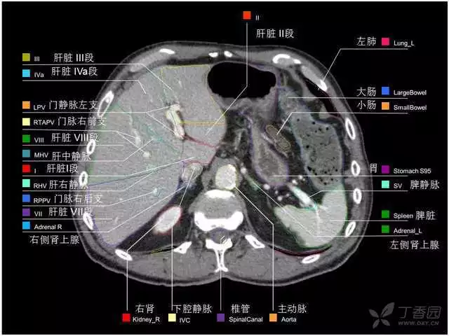 掌握这篇解剖，晋级腹部CT影像诊断高手（精细版）