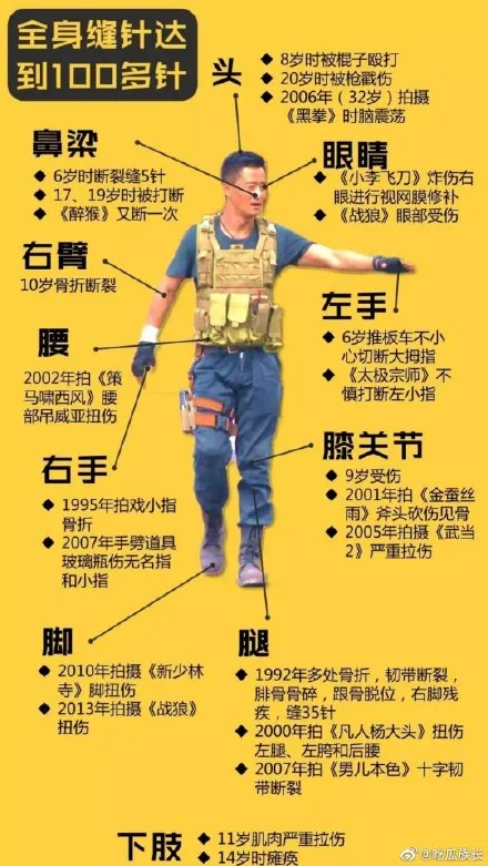 吴京伤情报告曝光,全身缝合100多针:硬汉?你太小看他了