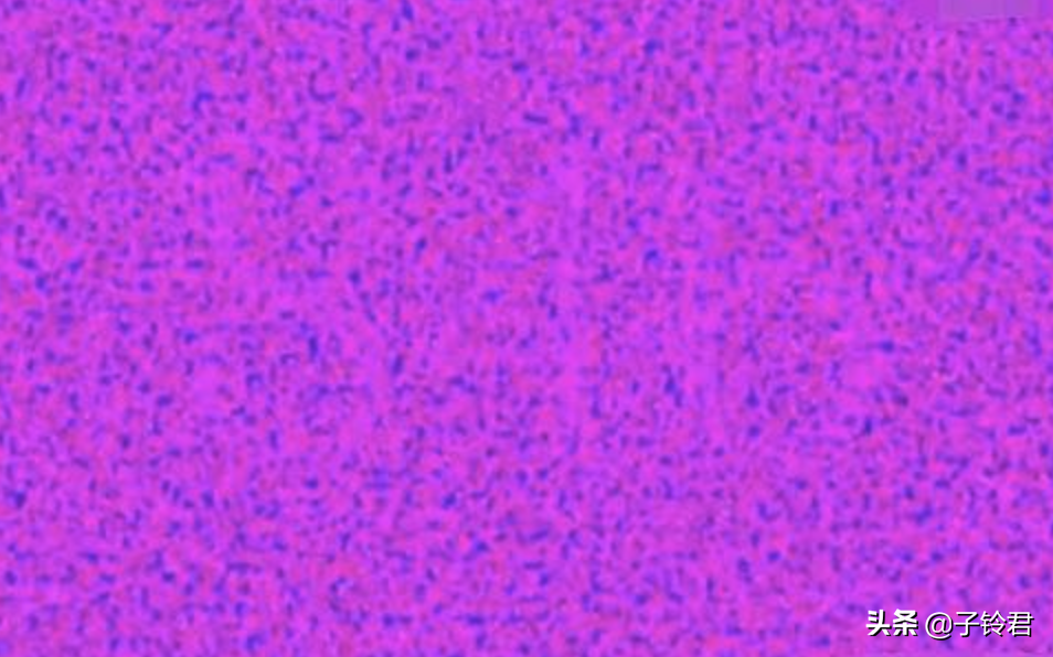 飞行员的视力测试图，认出2个是行家，全部认出