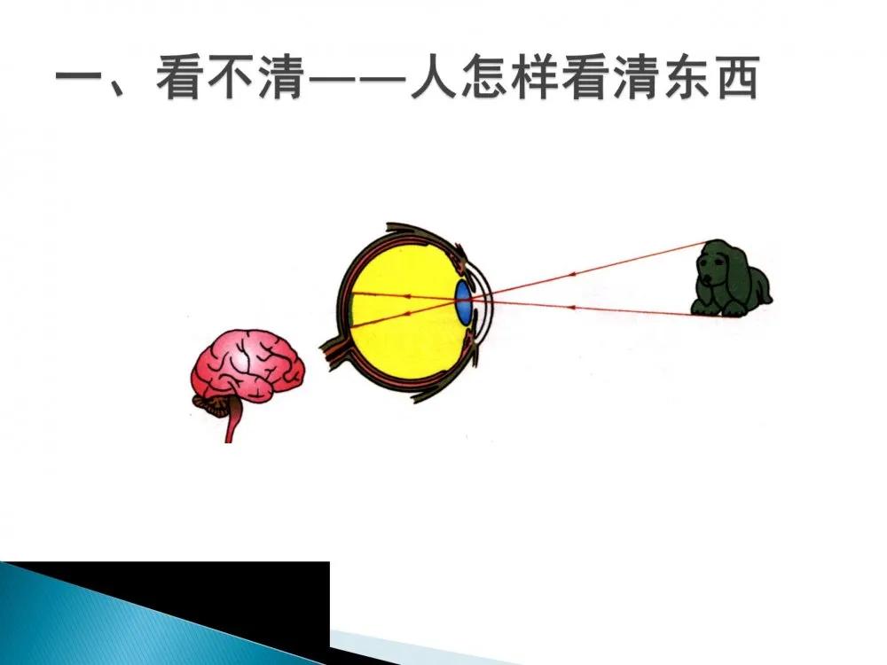 健康科普大赛获奖作品展示⑤|老年人常见眼部不适