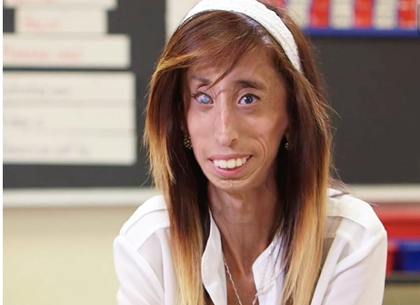 网红\"零脂肪女孩\"，曾经被人恶言相向，