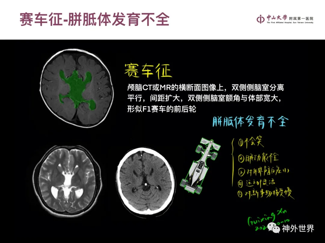 最全影像总结 | 颅内病变 MR、CT 的阅片技巧，太赞了
