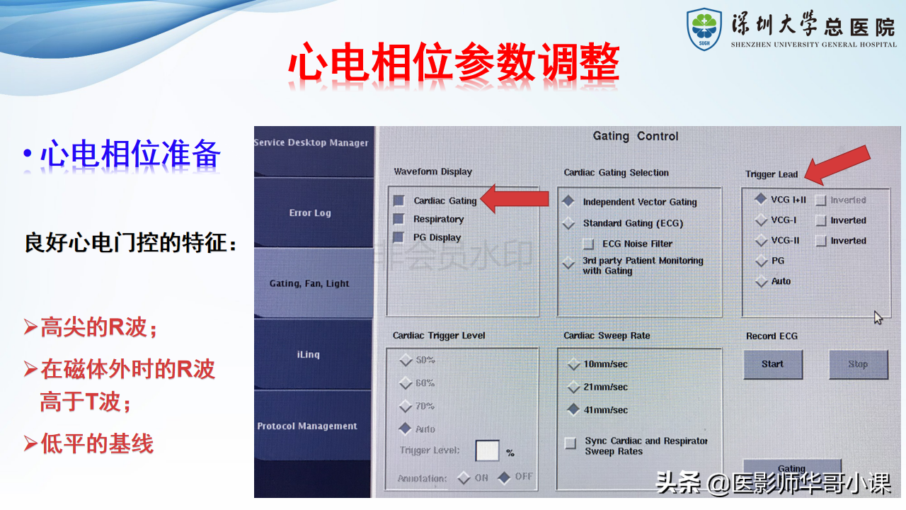 磁共振非增强双下肢血管MRA
