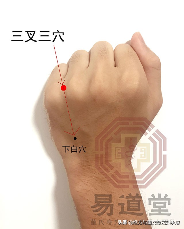 董氏奇穴三叉三穴治療各類疾患的應用解密|