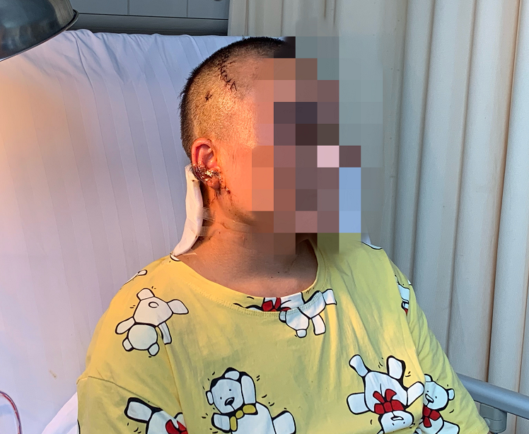 让人心痛!继父连砍4刀，女孩面临高位截瘫：孩子