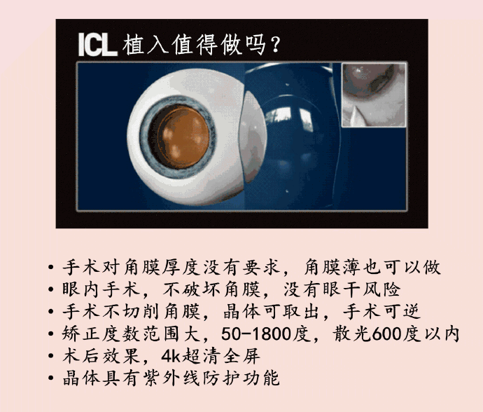 Icl專家答疑彙總 關於icl 你想知道的都在這裏 同仁眼科熊瑛 Mdeditor