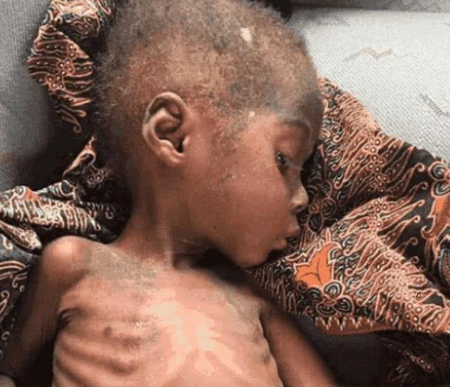 3岁小孩喝水都是奢望在街头乞讨，被美国女人领回家后，如今怎样