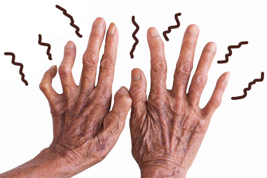 Nine reasons for hand numbness. Don't just know about cervical