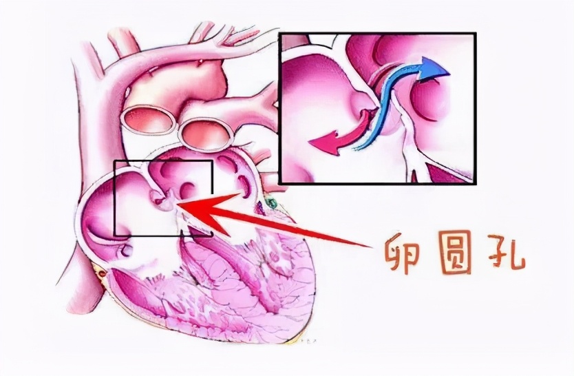 “多个心眼”倒霉了！57岁大妈肾、肺、脑血管堵塞，居然是“心眼”出问题了？