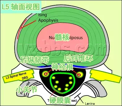 手把手教你：腰椎间盘突出CT和MRI读片技巧