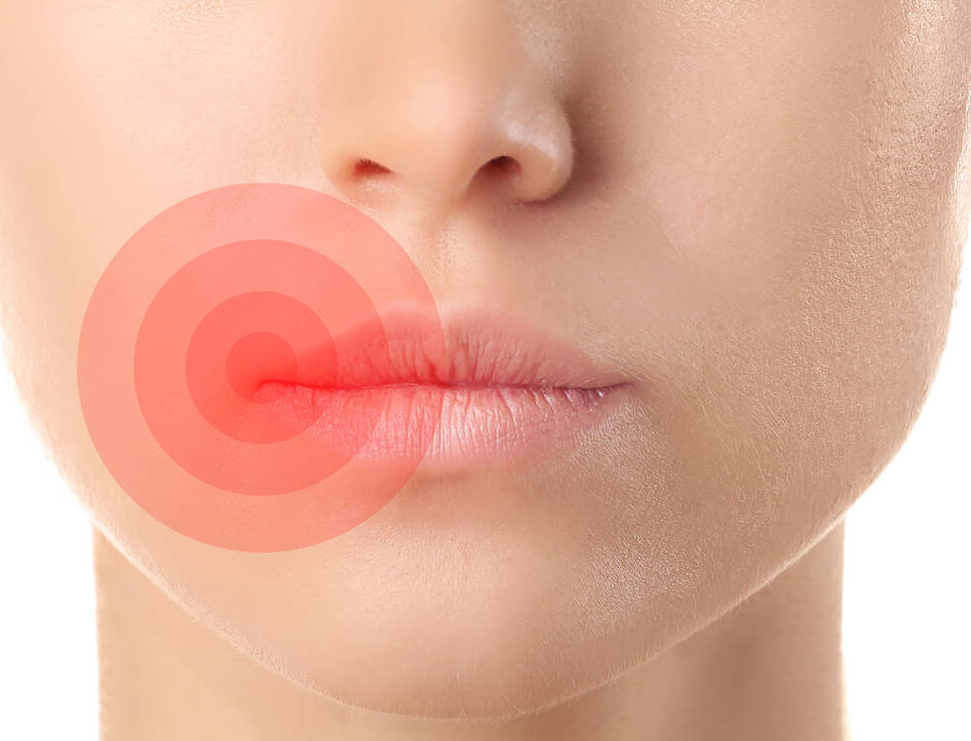經常爛嘴角、疼痛難耐，或是4個原因，做到3點，保護嘴唇效果好