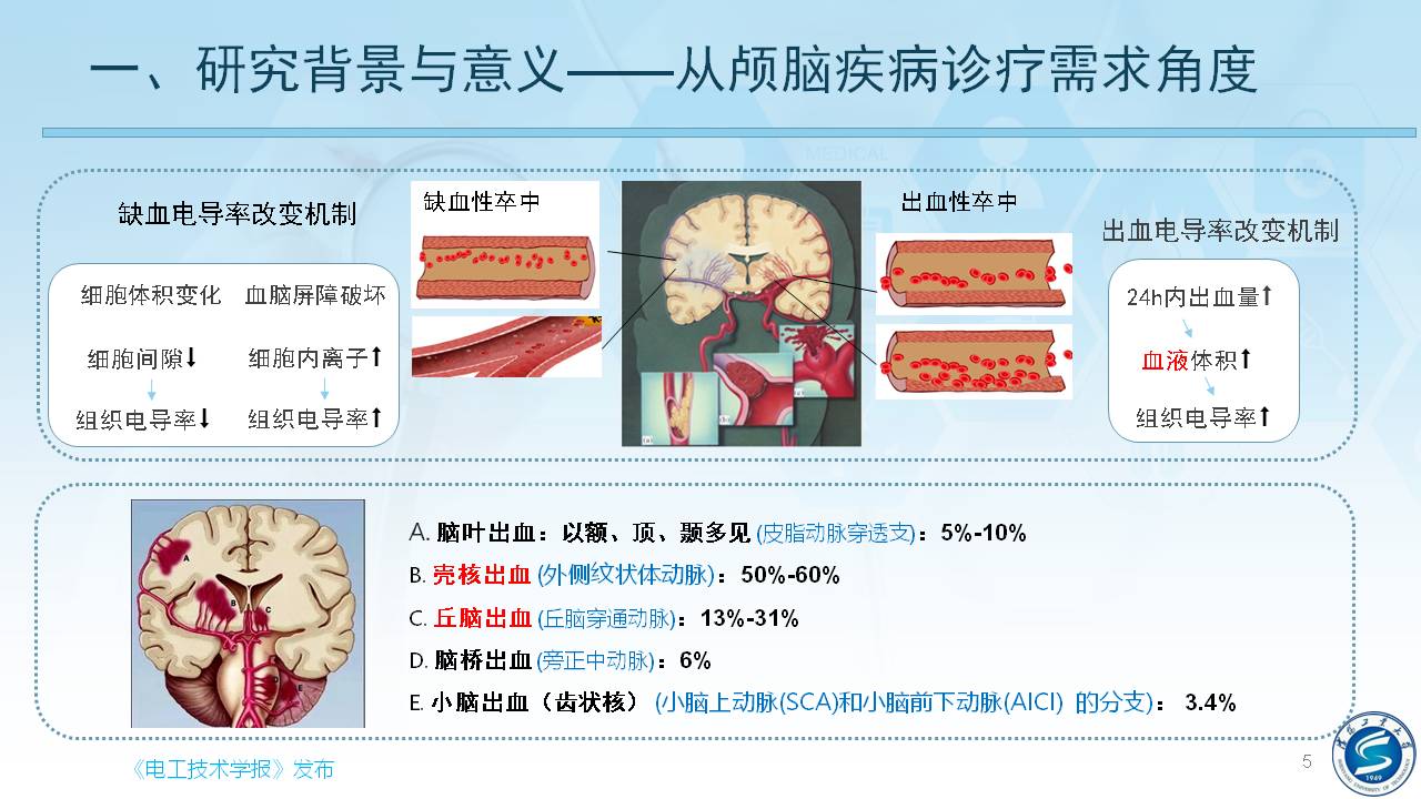 沈陽工業(yè)大學(xué)柯麗教授：感應(yīng)式顱腦電磁特性檢測與成像方法研究