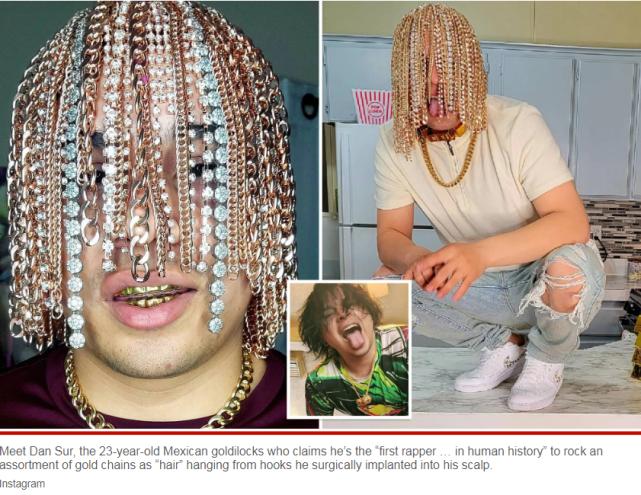 It Hurts To Look At It Mexican Rapper Implanted Dozens Of Gold Chains it-hurts-to-look-at-it-mexican-rapper-implanted-dozens-of-gold-chains