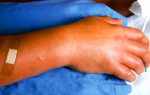 死法最痛苦的日本人：遭核辐射后想安乐死，却