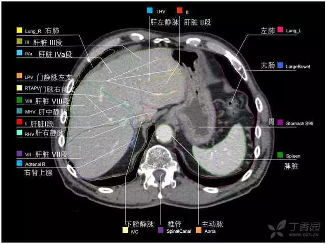 掌握这篇解剖，晋级腹部CT影像诊断高手（精细版）