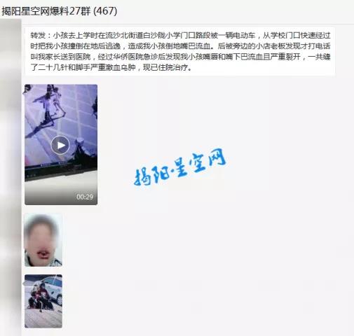 肇事逃逸 揭阳路段小孩被电动车撞倒 下巴严重裂开 社会 爆资讯新媒体平台