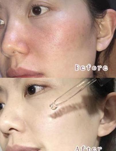 屈臣氏的“国宝”精华液火了！李佳琦强烈推荐