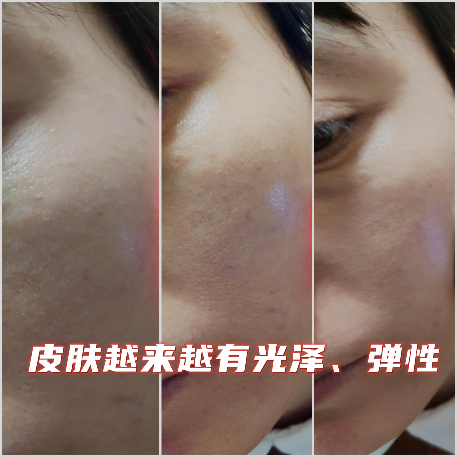 唤醒肌肤 重现青春 Notime射频美容仪入手体验