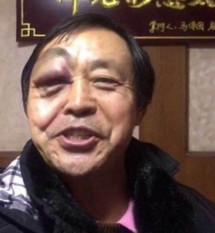 一碰就倒了的太极宗师马保国, 让我为国术担忧呀！