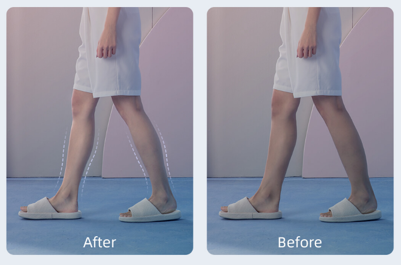 小米有品上架“脂肪粉碎机”，来自日本的黑科