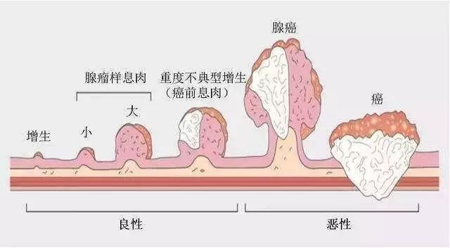 黑豹主演博斯曼肠癌去世，年仅43岁——做个检查就能避免悲剧