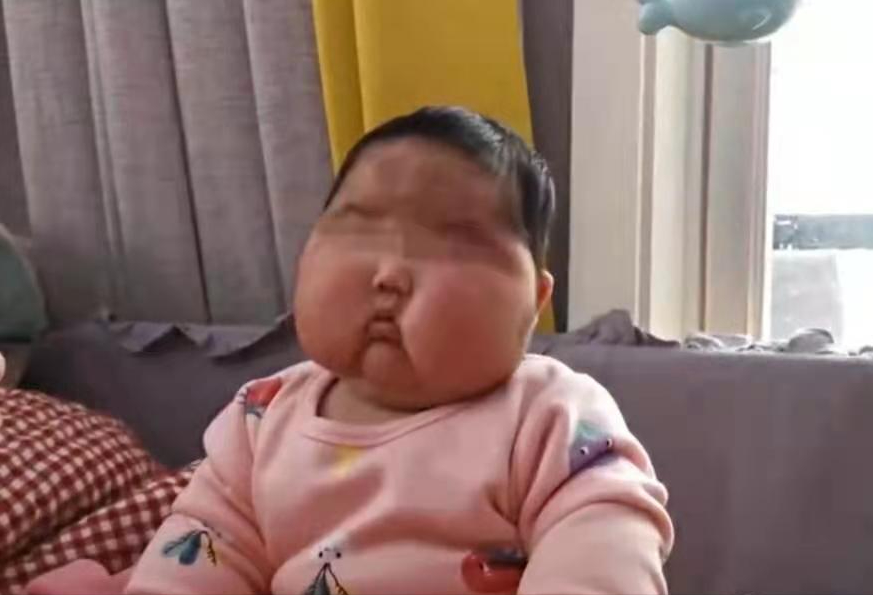 因用护肤霜，3个月的婴儿额头长满浓密汗毛，体重猛增但身高不长