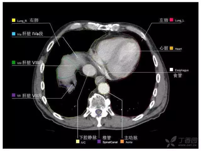 掌握这篇解剖，晋级腹部CT影像诊断高手（精细版）