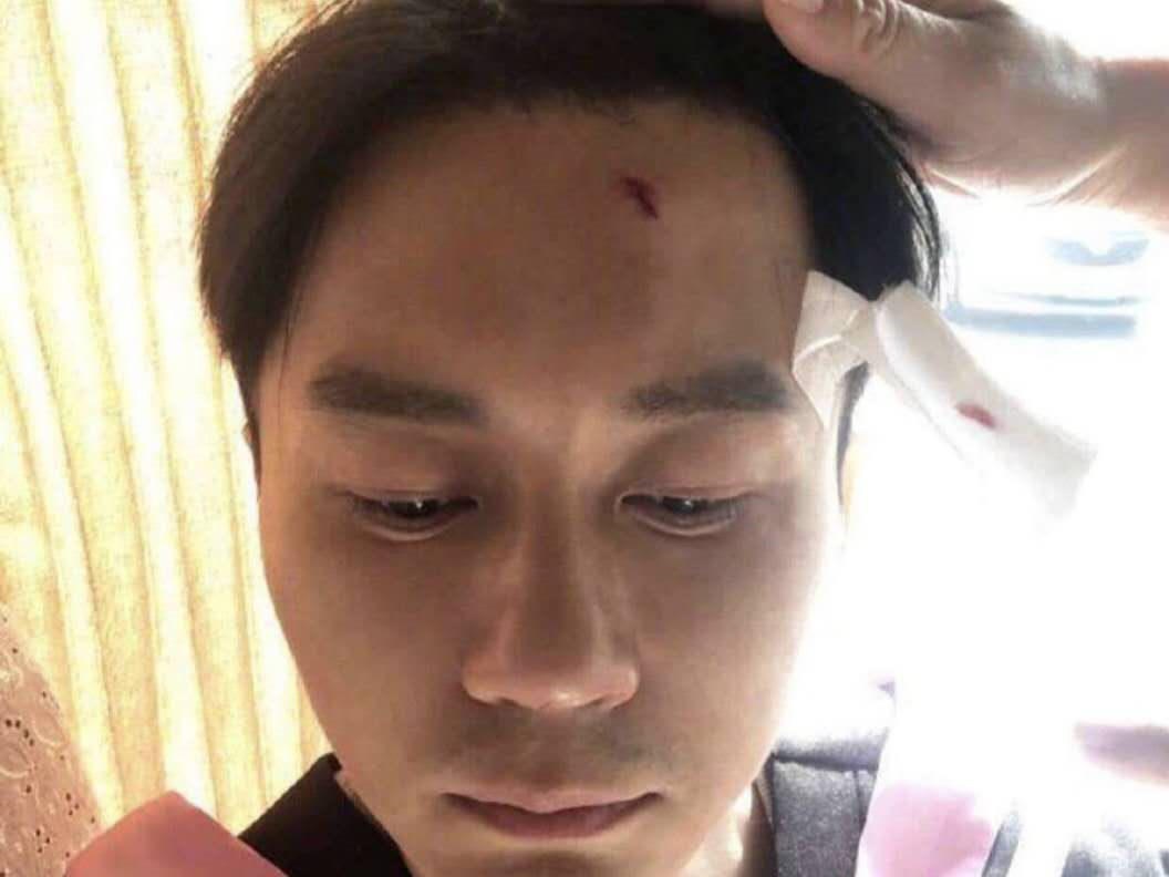 都以为综艺赚钱快又轻松，但明星受伤可不在少