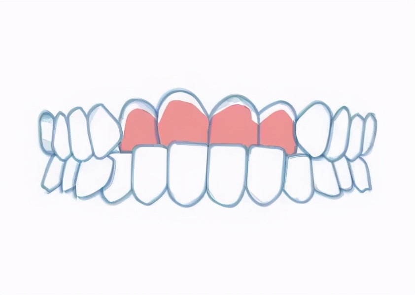 笑研所科普：口周美学